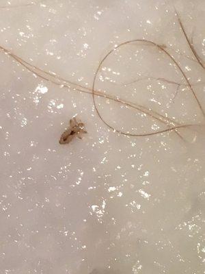 A louse extracted from a child's hair.