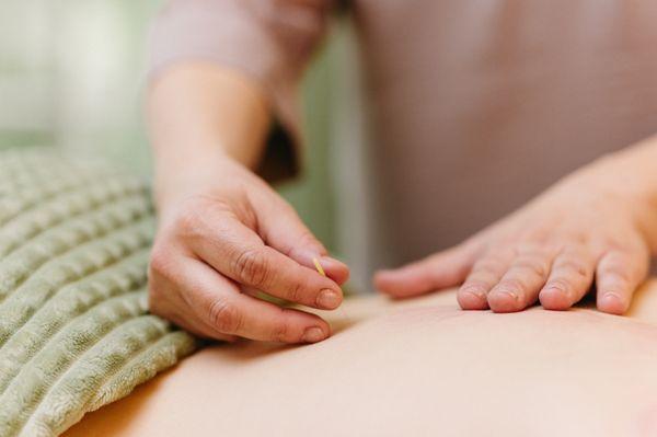 Living Light Acupuncture