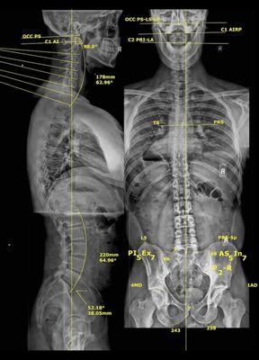 X-RAYS = PEACE OF MIND VIA PRECISE METRICS & PRACTICES