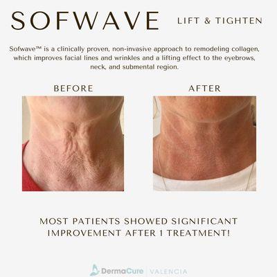 Dermacure Equestrian Skin Care