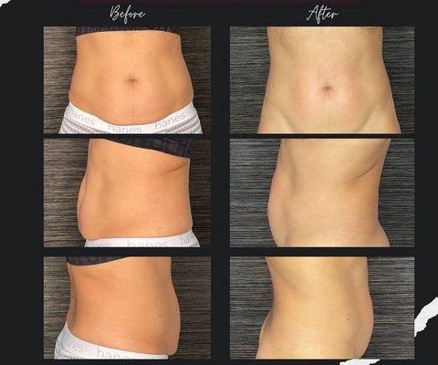 Injection Bar Medspa & Wellness