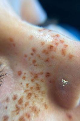 -FAUX FRECKLES REALISTIC -