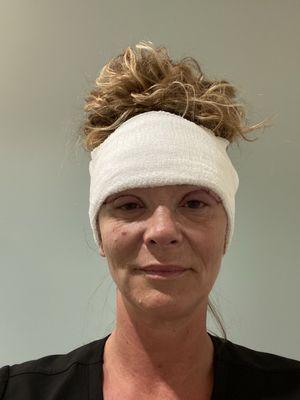 1 hour post surgery!