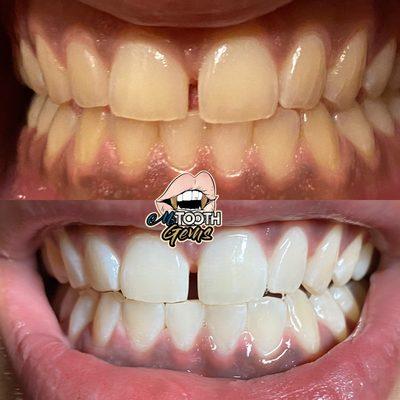 One hour session! 10 shades brighter