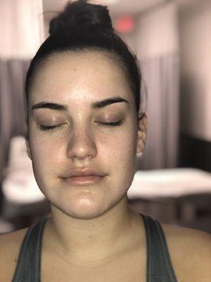 Fresh faced after a GLOW facial