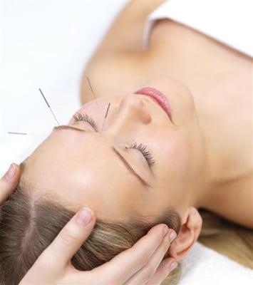 Facial Rejuvenation acupuncture