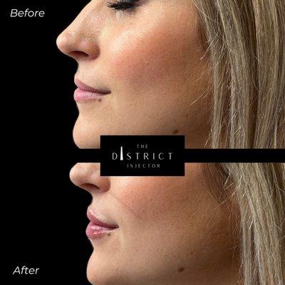 The District Injector