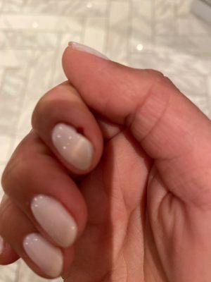 Its not nail art, its a bleeding finger!