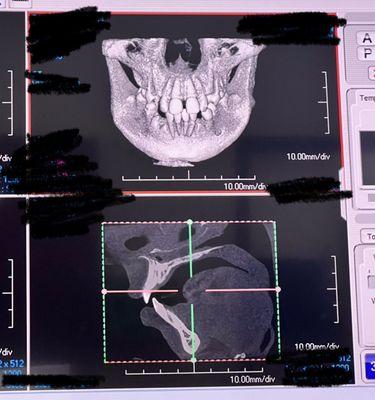 Merrill Ranch Family Dental