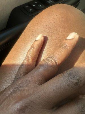 After the ring was off