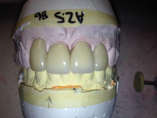 Rosenfeld Dental Lab