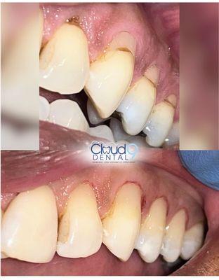 Yoni Mizrahi - Cloud 9 Dental