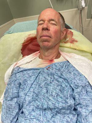 Hours after the accident in the hospital. Lots of blood and pain