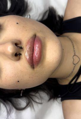 Plump & Pouty Aesthetics