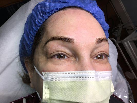 Eyebrow microbrused.