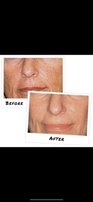 Vibrant clean skin radiates youth!!!