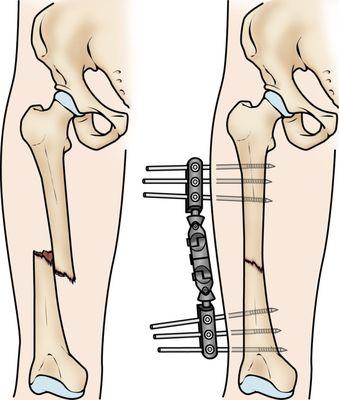 Ottey Bone & Joint Associates