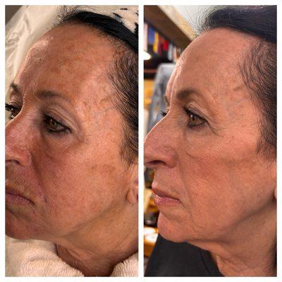 Angels Med Spa Los Angeles