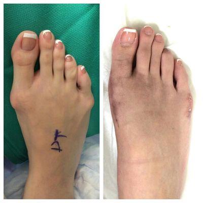 Brooke M Dix, DPM, MS - Smart Foot Podiatry