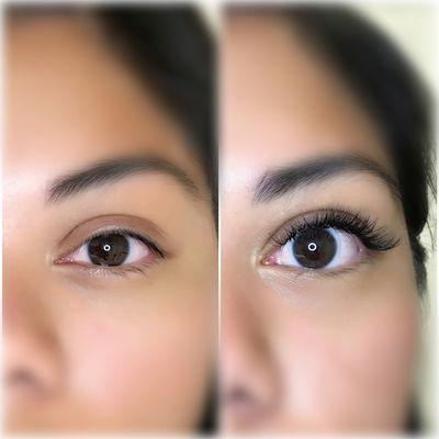 Hybrid (mix of classic and volume) set