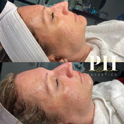 PowerHouse Esthetics