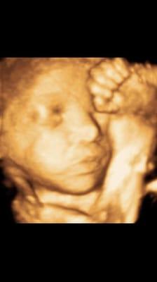 Diagnostic Ultrasound Suite