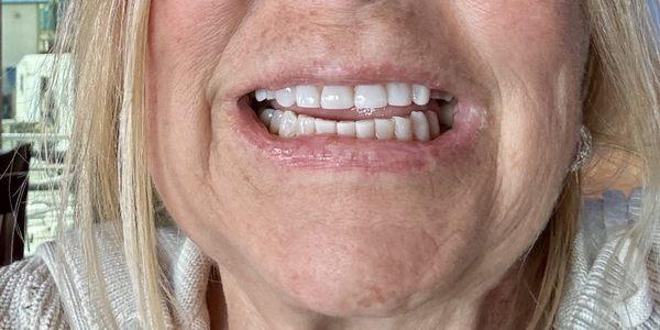 Seacrest Dental - Miramar Beach