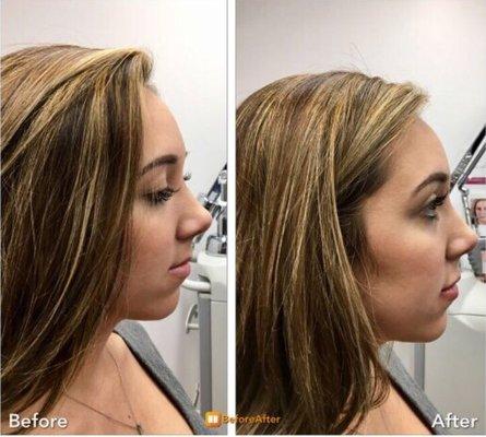 Advanced Laser Aesthetics