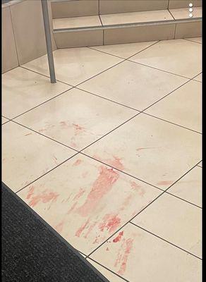 Blood all over the lobby