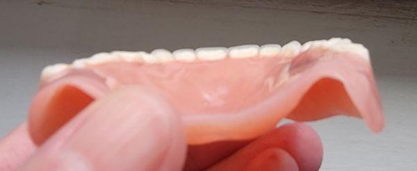 Affordable Dentures & Implants