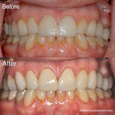 Aparna Subramanian, DDS