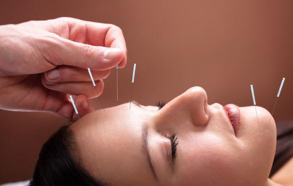 Louisville Family Acupuncture