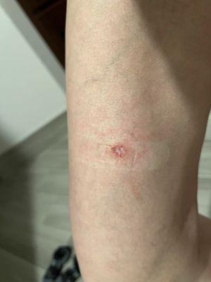 Dermatology of Virginia