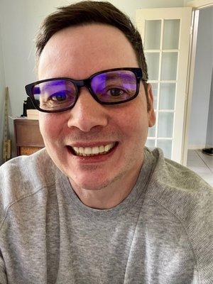 Post 5 implants later.