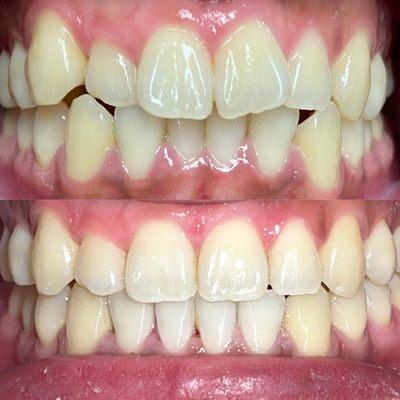 Oxy Dental of South Gate