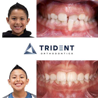 Trident Orthodontics Eastvale