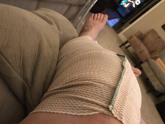 Knee at home...day one.