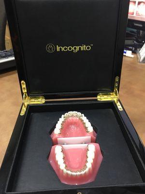 The Cadillac of braces!