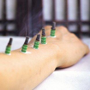 Moxibustion can be used to prevent diseases and maintain health as part of tonification treatments to help strengthen the organs and immun