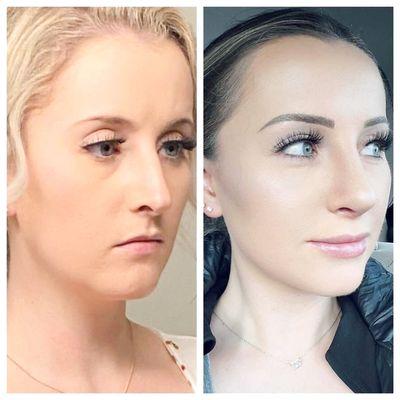 JMISKO surgical design | md