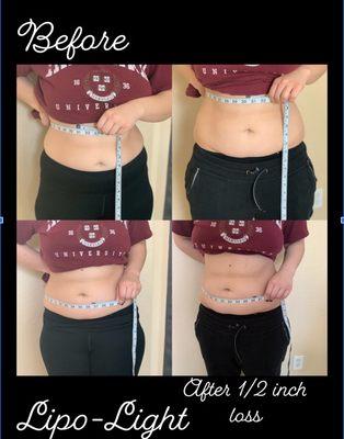 1/2" loss after 1 Lipolight session, the lipopads penetrate the fat cells and empty them. Your body then naturally disposes of the fat.