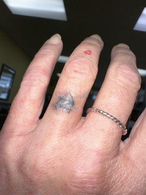 Horrible "cover" with scar tissue