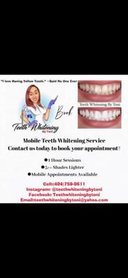 Mobile Teeth Whitening Service
60-90 min sessions
5+ shades lighter