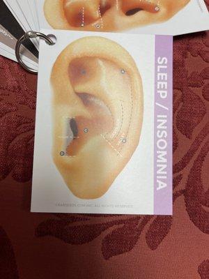 Jung Yun Acupuncture