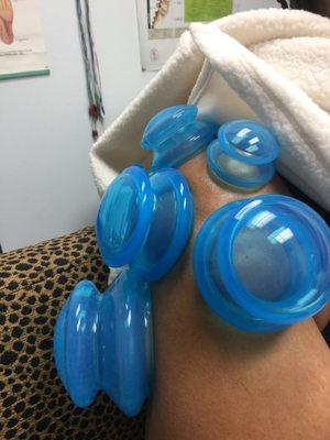 Cupping