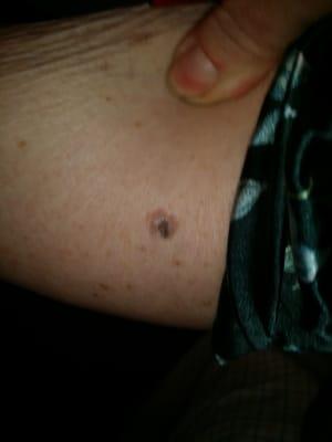 Dr. Susans gone Susan gone. A valley girl is. . missedmy cancer. If you get stuck with the new Valley Girl Demand the MD .