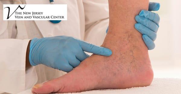 If you have pain or swelling in your limbs it could be related to vein abnormalities! At our facility, we offer Venography - ...