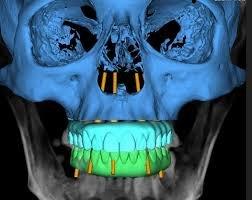 Lakeshore Oral & Maxillofacial Surgery