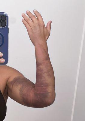 BioLife Plasma Services