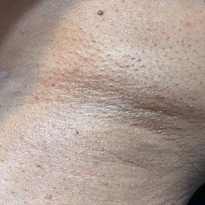 Under arm wax